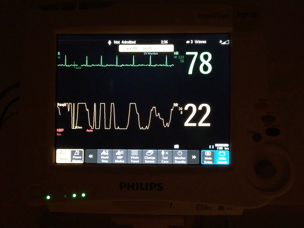A close-up photo of a medical monitor in a dark room. Image courtesy of Lizzy Rose